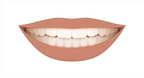 Orinda CA Orthodontist, Braces & Invisalign